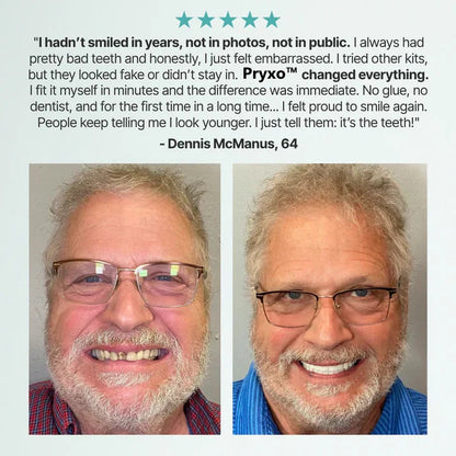 🌎Ends Today: 70% OFF! ⏰ Medical Full Denture with Strong Suctiond🦷Obtain American Dental Association (ADA) Certification